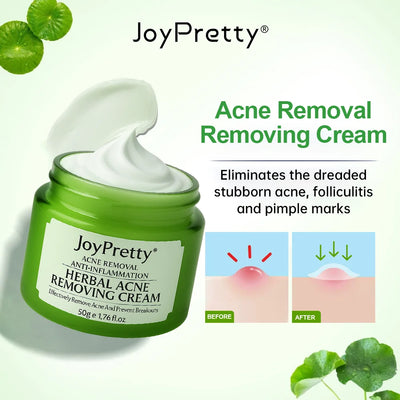 JoyPretty Herbal Acne Treatment Face Cream Elimination Large Pores Oil Control Shrink Pore Facial Cream Skin Care Beauty Health Revive