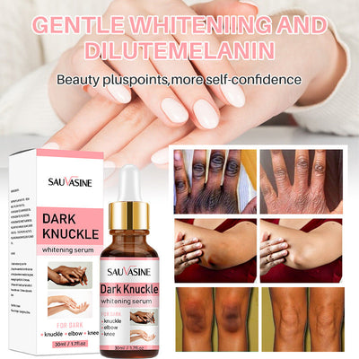 Finger Brightening Hand Care Fade Black Hand Care Solution CuddleNest Enterprise